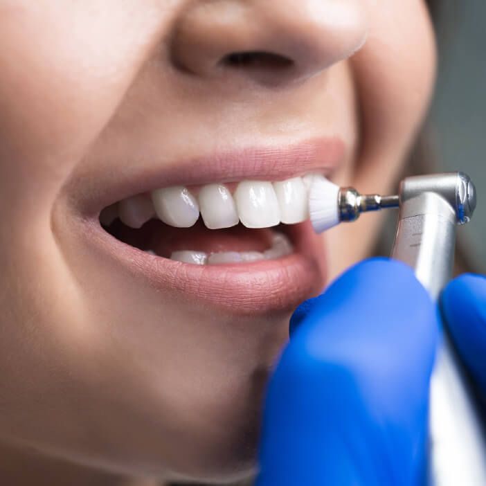 Dental Cleaning | National Dental