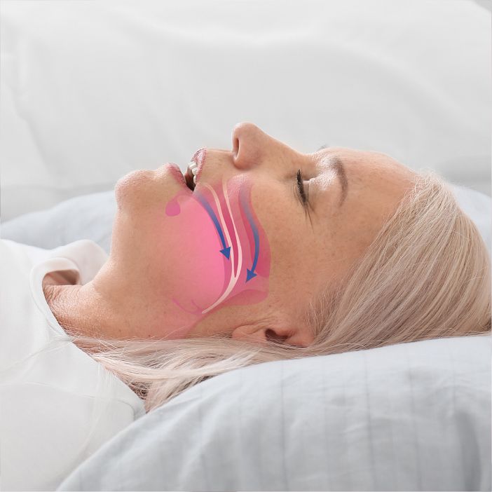 Sleep Apnea | National Dental